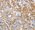 MLH1 Polyclonal Antibody – Figure 1 of 2