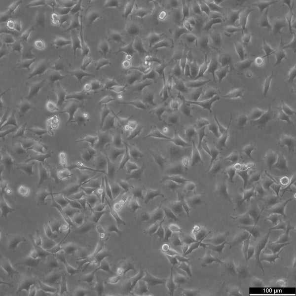 OVCAR-5 cell