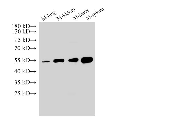 Angiotensinogen Polyclonal Antibody – Figure 1 of 4