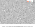 Immortalized Human Aortic Endothelial Cells - SV40T & hTERT – Figure 1 of 1