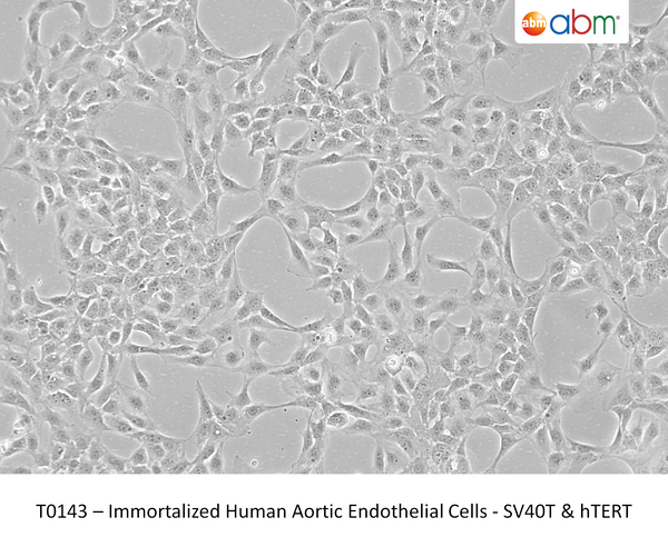 Immortalized Human Aortic Endothelial Cells - SV40T & hTERT – Figure 1 of 1