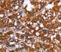 GAGE12I Polyclonal Antibody – Figure 1 of 3