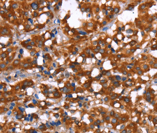 GAGE12I Polyclonal Antibody – Figure 1 of 3