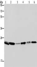 ARHGDIA Polyclonal Antibody – Figure 1 of 4