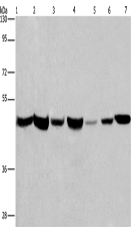 APMAP Polyclonal Antibody – Figure 1 of 4