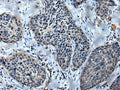 ULK4 Polyclonal Antibody – Figure 1 of 2