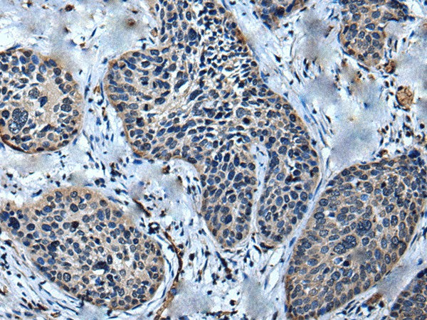 ULK4 Polyclonal Antibody – Figure 1 of 2