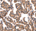 hCG Polyclonal Antibody – Figure 1 of 3