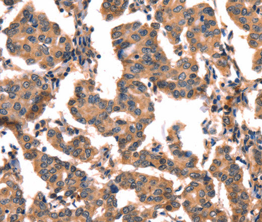 hCG Polyclonal Antibody – Figure 1 of 3