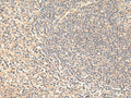 SULT4A1 Polyclonal Antibody – Figure 1 of 2