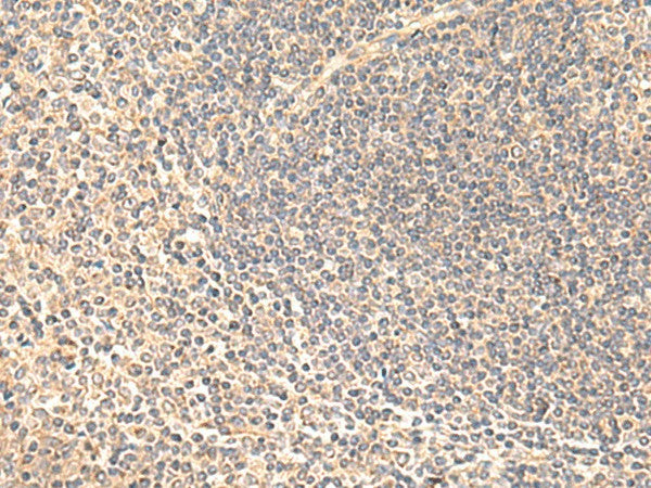 SULT4A1 Polyclonal Antibody – Figure 1 of 2