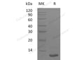 Recombinant Human LR3-IGF-1 Protein (MG) – Figure 1 of 2