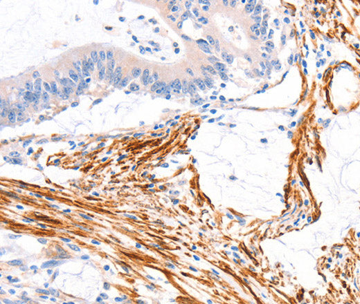 ARAP1 Polyclonal Antibody – Figure 1 of 2