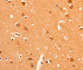 GRM3 Polyclonal Antibody – Figure 1 of 2