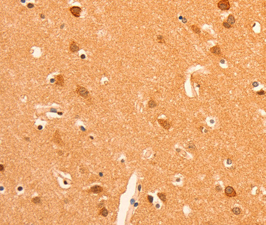 GRM3 Polyclonal Antibody – Figure 1 of 2