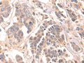 LRRC15 Polyclonal Antibody – Figure 1 of 3