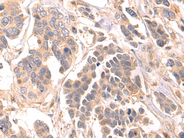 LRRC15 Polyclonal Antibody – Figure 1 of 3