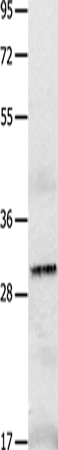 IL2RA Polyclonal Antibody – Figure 1 of 2