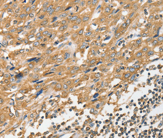 ANGPTL7 Polyclonal Antibody – Figure 1 of 2