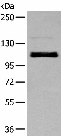ZNF281 Polyclonal Antibody – Figure 1 of 4