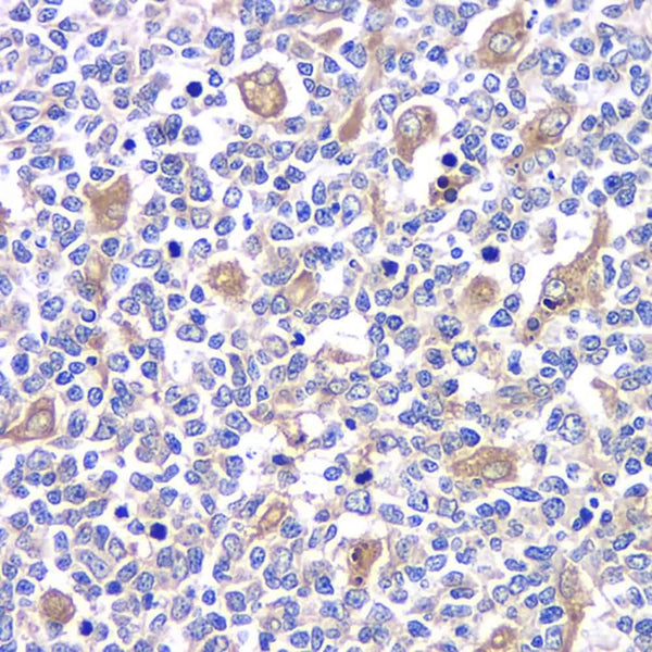 TLR9 Polyclonal Antibody – Figure 1 of 3