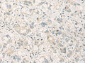 SPSB2 Polyclonal Antibody – Figure 1 of 2