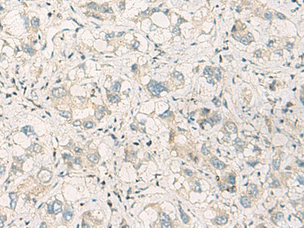 SPSB2 Polyclonal Antibody – Figure 1 of 2