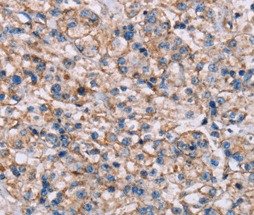 ADAM12 Polyclonal Antibody – Figure 1 of 2