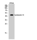 CK-19 Polyclonal Antibody – Figure 1 of 4