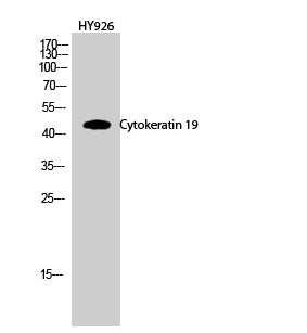 CK-19 Polyclonal Antibody – Figure 1 of 4
