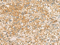 AIMP1 Polyclonal Antibody – Figure 1 of 3