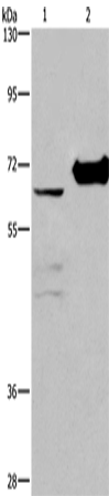 CHDH Polyclonal Antibody – Figure 1 of 2