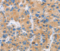 DKK2 Polyclonal Antibody – Figure 1 of 2