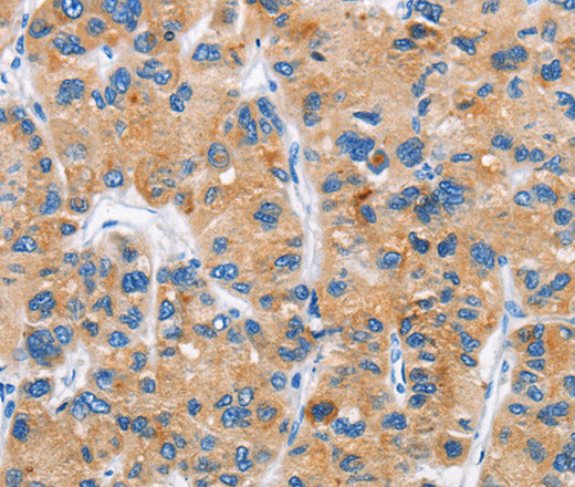 DKK2 Polyclonal Antibody – Figure 1 of 2