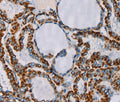 CMC4 Polyclonal Antibody – Figure 1 of 3