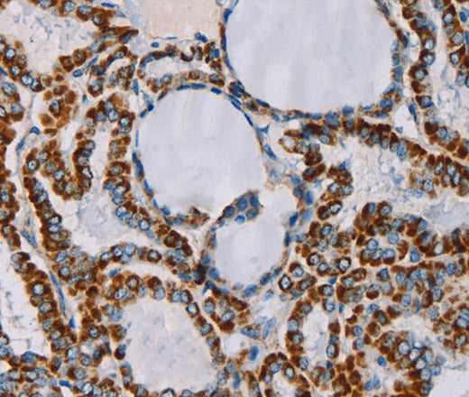CMC4 Polyclonal Antibody – Figure 1 of 3