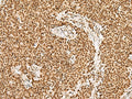 GRSF1 Polyclonal Antibody – Figure 1 of 3
