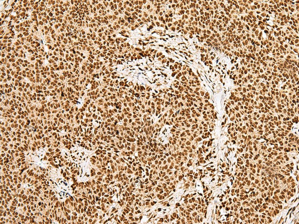 GRSF1 Polyclonal Antibody – Figure 1 of 3