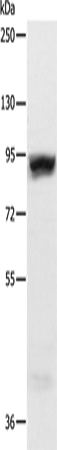 RRM1 Polyclonal Antibody – Figure 1 of 2