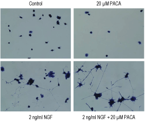 PACA – Figure 1 of 2