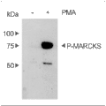 PMA – Figure 1 of 2