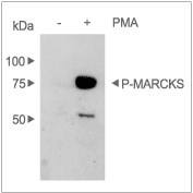 PMA – Figure 1 of 2