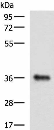 GRHPR Polyclonal Antibody – Figure 1 of 3