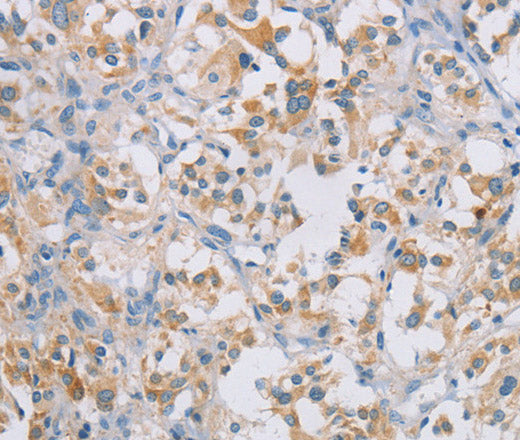 CERKL Polyclonal Antibody – Figure 1 of 3