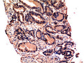 CASP3 Monoclonal Antibody – Figure 1 of 3