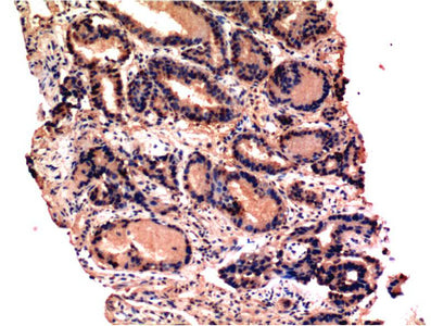 CASP3 Monoclonal Antibody – Figure 1 of 3