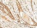 RMND5B Polyclonal Antibody – Figure 1 of 3
