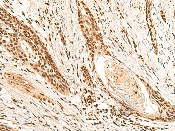 RMND5B Polyclonal Antibody – Figure 1 of 3