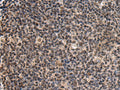 SIK3 Polyclonal Antibody – Figure 1 of 3