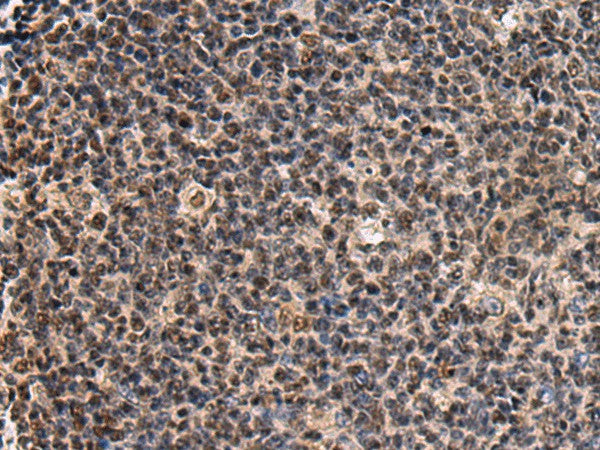 SIK3 Polyclonal Antibody – Figure 1 of 3